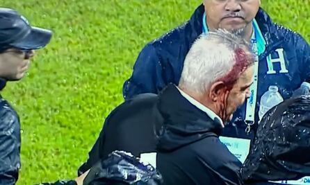 Javier Aguirre termina descalabrado por la afición de Honduras; previo a eso, recibió escupitajo 