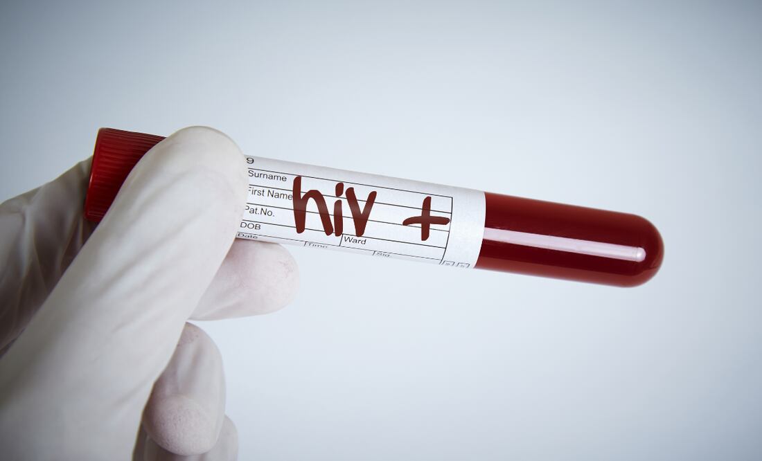 En lo que va de 2023 se registran 316 casos de VIH | Imagen ilustrativa