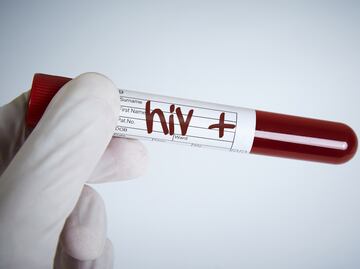 Al menos 28 casos de VIH en la región Tulancingo y Otomí Tepehua