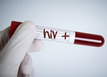 Al menos 28 casos de VIH en la región Tulancingo y Otomí Tepehua