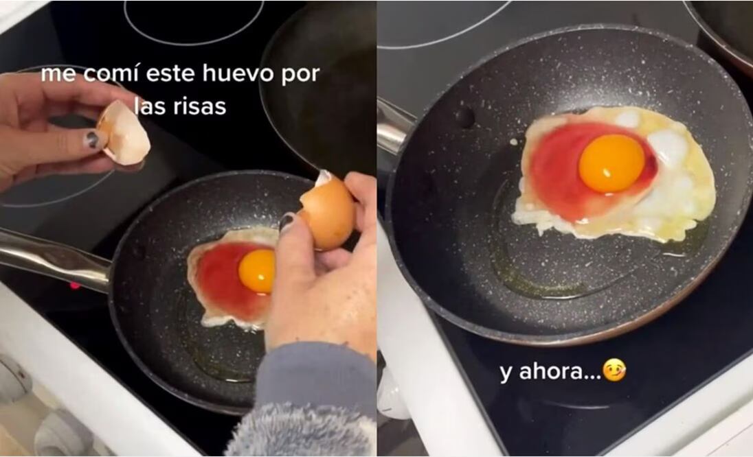 El huevo causó una infección grave al hombre que lo comió | Capturas de video