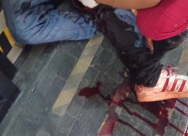 Hombre baleado es arrojado a la vía pública en Tulancingo