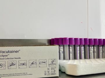 Hidalgo por debajo de la media nacional en donación de sangre altruista; solo el 3% opta por donar