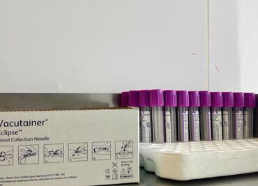 Hidalgo por debajo de la media nacional en donación de sangre altruista; solo el 3% opta por donar