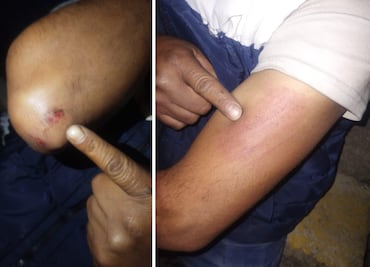 Comerciante denuncia agresión por parte de policías en Acaxochitlán