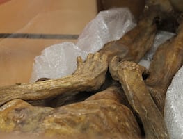 UAEH impulsa investigación multidisciplinaria para conservar momia histórica de Tepeji del Río