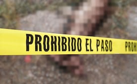 Localizan pierna humana en estado de descomposición en Tula