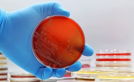 Prevención de infección por salmonella en época de calor