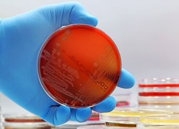 Prevención de infección por salmonella en época de calor