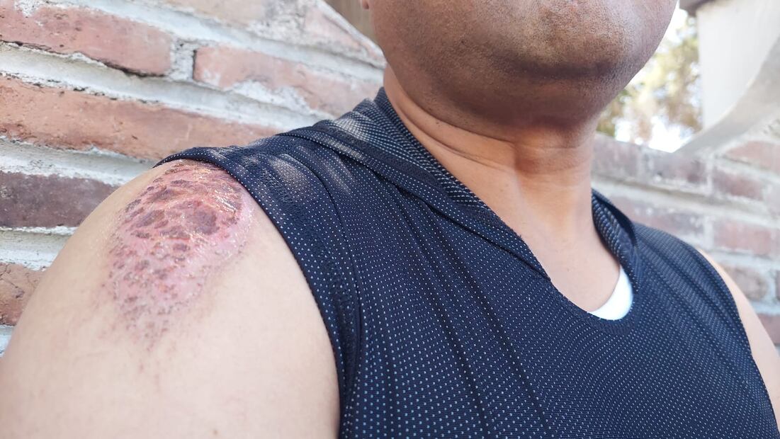 Víctimas del accidente en bulevar Santa Catarina piden cobertura de gastos médicos | Foto: Lorena Rosas