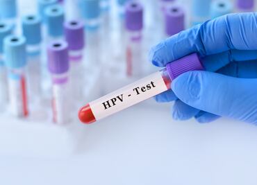 Avanza campaña de vacunación contra el VPH en Hidalgo; 74 % de la meta alcanzada