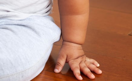 Alerta en primarias de Hidalgo: obesidad, problemas visuales y caries afectan a estudiantes