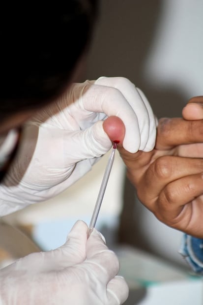 Hidalgo refuerza su estrategia integral contra el VIH-Sida en el Día Mundial del Sida | Foto: Salud Hidalgo