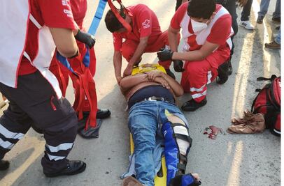 Alumno del ITH sufre aparatosa lesión en accidente vial