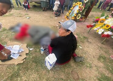 Explosión de pirotecnia deja gravemente herido a hombre en Atotonilco El Grande