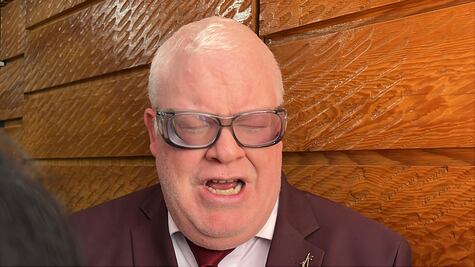 Se desconoce cantidad de personas en Hidalgo con albinismo para poder crear políticas públicas