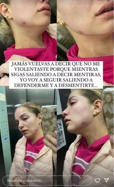 Sandra Itzel compartió en sus redes sociales pruebas de que su ex, Adrián Di Monte, sí la maltrató, luego de que él lo negara.