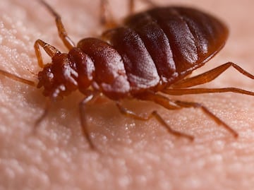 ¿Las chinches son sinónimo de mala higiene?