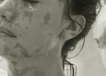 “El sistema enmascara la injusticia como justicia”: Leslie, sobreviviente de ataque con ácido