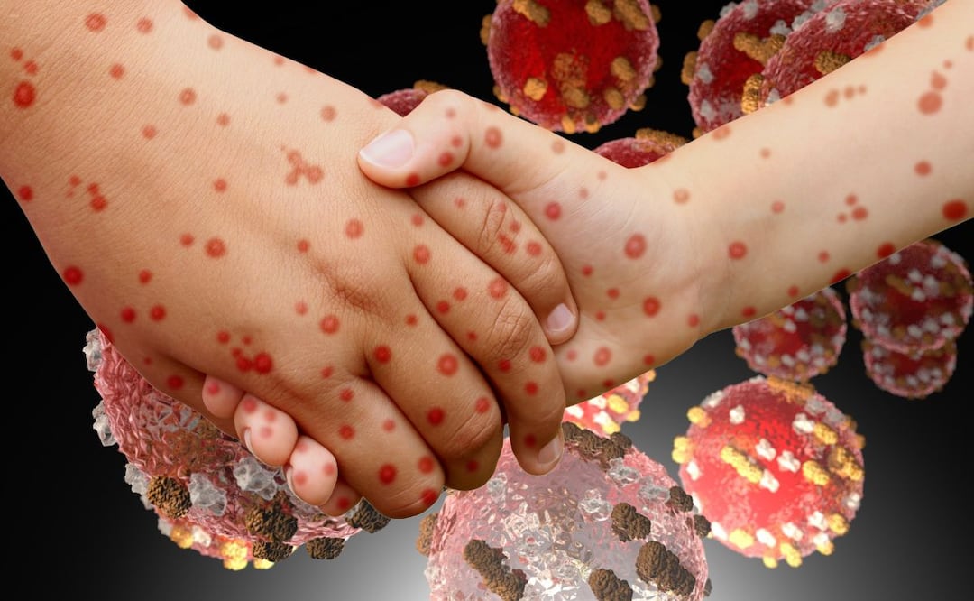 Autoridades mantienen vigilancia epidemiológica | Imágenes ilustrativas