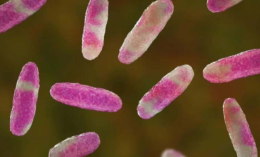 bacteria Klebsiella Oxytoca I Foto: Pixabay