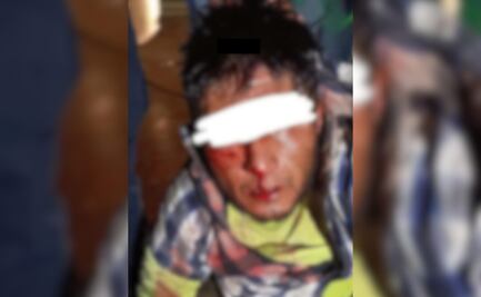 Vecinos golpean a presunto ladrón en Actopan