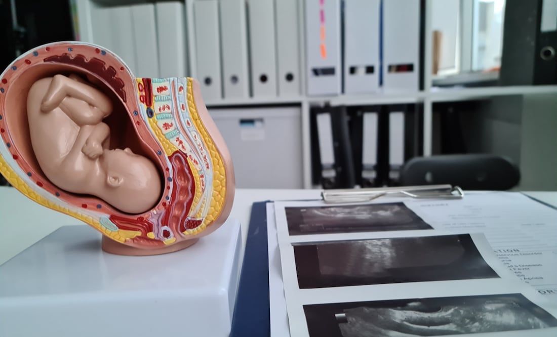 En Hidalgo, diputados aprobaron la despenalización del aborto el 30 de junio de 2021 | Foto: Getty Images