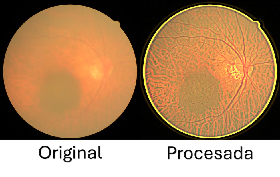 La UPT desarrolla tecnología para detectar enfermedades oculares a bajo costo | Imagen: SEPH