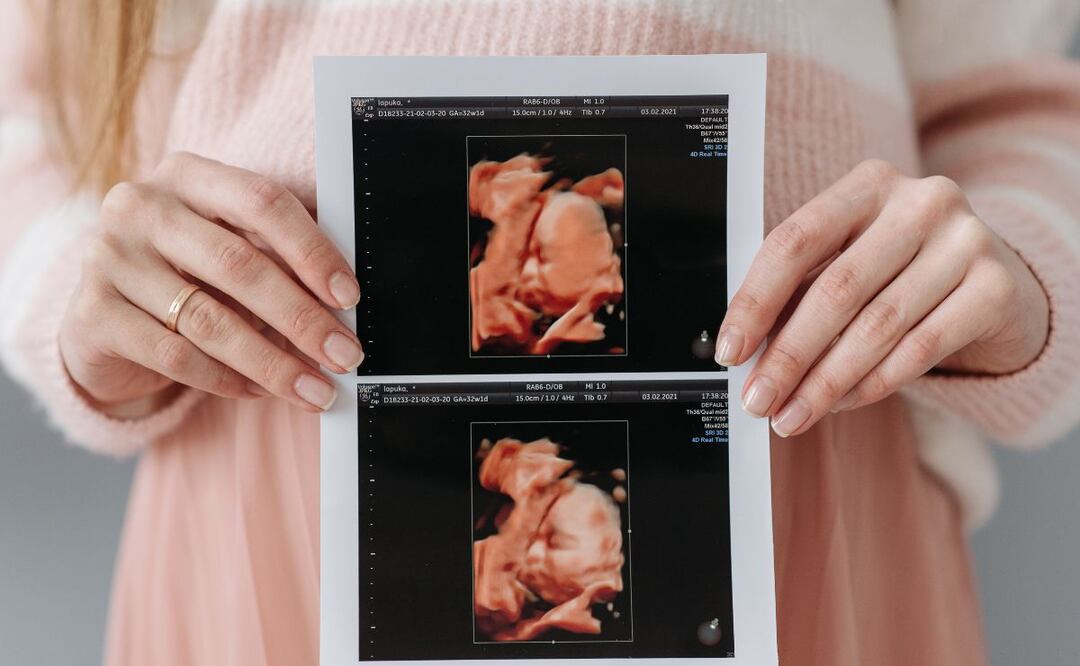 Incrementan muertes maternas en Hidalgo; suman seis | Foto: Pexels