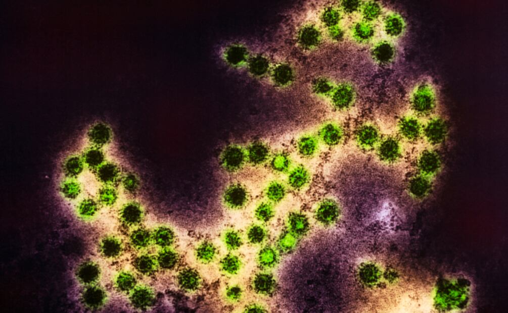 Aumento de casos de virus Coxsackie en Hidalgo; llaman a reforzar medidas preventivas | Foto: sciencephoto