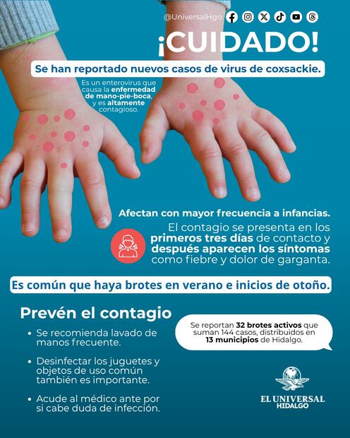 Reitera Salud Hidalgo medidas preventivas ante casos de enfermedad “manos, pies y boca” | Diseño: Michelle Guadarrama