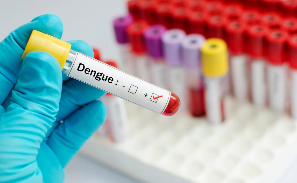 Registran 172 casos de dengue en Hidalgo en el año | Imagen ilustrativa