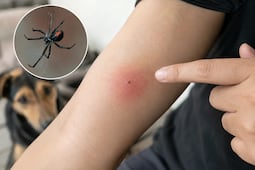 Aumentan 16% las mordeduras de araña atendidas en Hidalgo