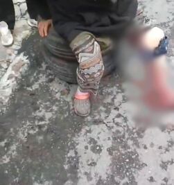 Mujer es atacada por jauría en calles de la colonia Cuauhtémoc en Pachuca