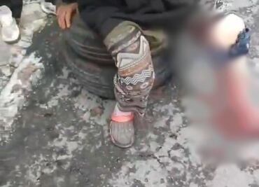 Mujer es atacada por jauría en calles de la colonia Cuauhtémoc en Pachuca