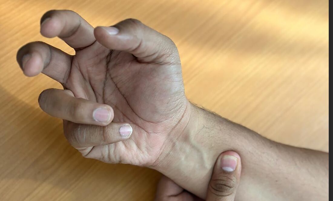 Foto: Gobierno de Hidalgo