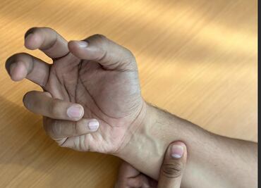 Implementan acciones en Hidalgo para evitar un brote del Síndrome de Guillain-Barré