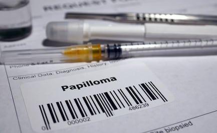 En Hidalgo se aplicarán 28.6 mil vacunas contra VPH