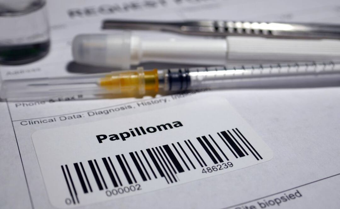 La vacuna contra del VPH es la medida de prevención más segura y eficaz para evitar el cáncer del cuello de la matriz causada por el Virus del Papiloma Humano.