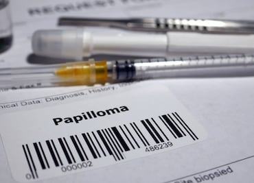 En Hidalgo se aplicarán 28.6 mil vacunas contra VPH