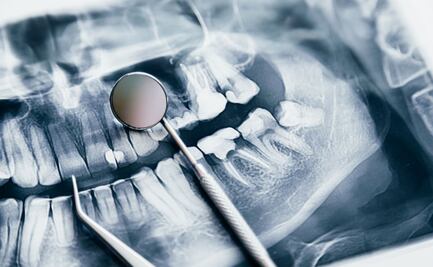 Hidalgo en marcha por una sonrisa saludable