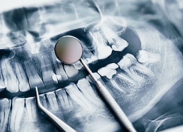 Hidalgo en marcha por una sonrisa saludable