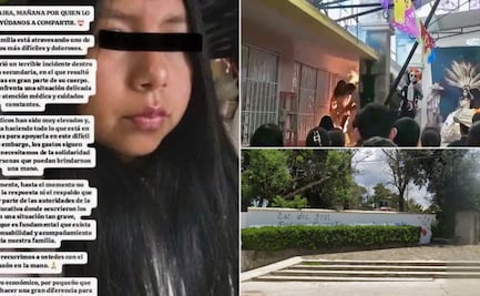 Piden 10 donadores de sangre para estudiante quemada durante evento escolar en Huasca