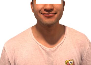 Riña en bar de Ixmiquilpan deja heridos y un detenido