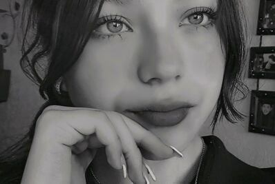 Pronósticos alentadores para Poulette, joven de 14 años, atropellada en Cuautepec 