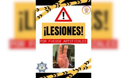 Impactante campaña contra la pirotecnia en Progreso de Obregón