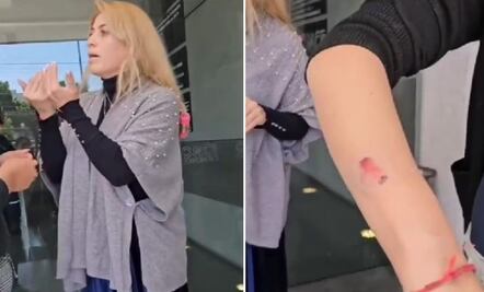 Mujer ataca con mordiscos a manicurista para no pagarle