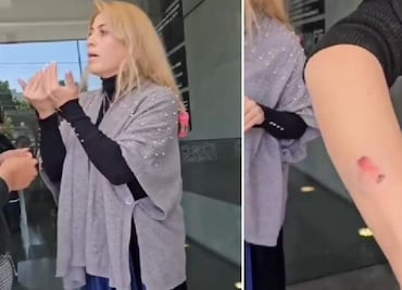 Mujer ataca con mordiscos a manicurista para no pagarle