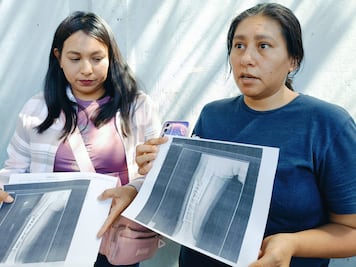 Joven de 20 años podría perder la pierna tras presunta negligencia médica en el IMSS