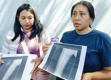 Joven de 20 años podría perder la pierna tras presunta negligencia médica en el IMSS